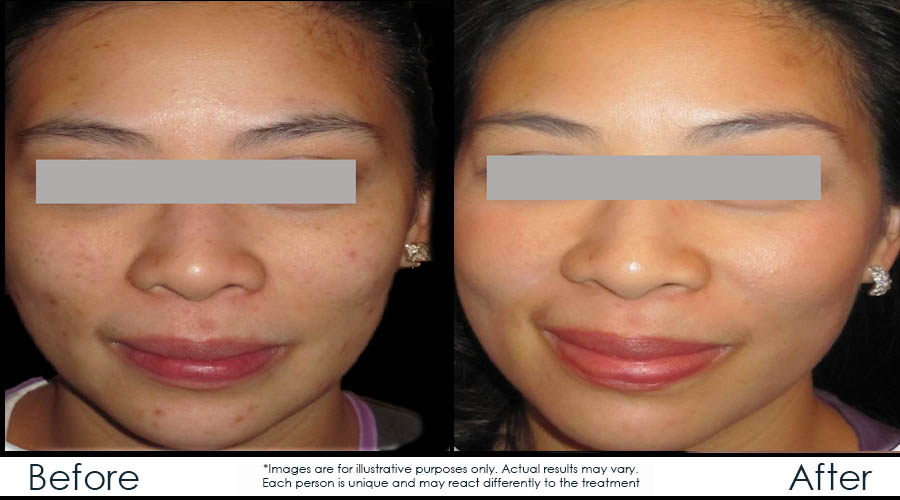 Infinium Médecine Esthétique | 729 Boulevard Saint-Joseph, Gatineau, QC J8Y 4B6, Canada | Phone: (819) 771-4284