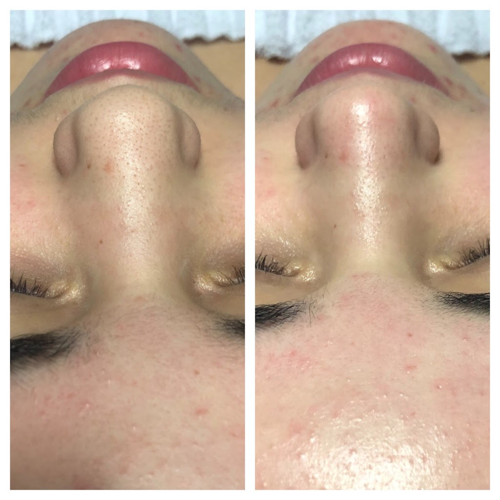 Ika Beauty | 6634 Rue Beaubien E, Montréal, QC H1M 3B3, Canada | Phone: (514) 575-7095