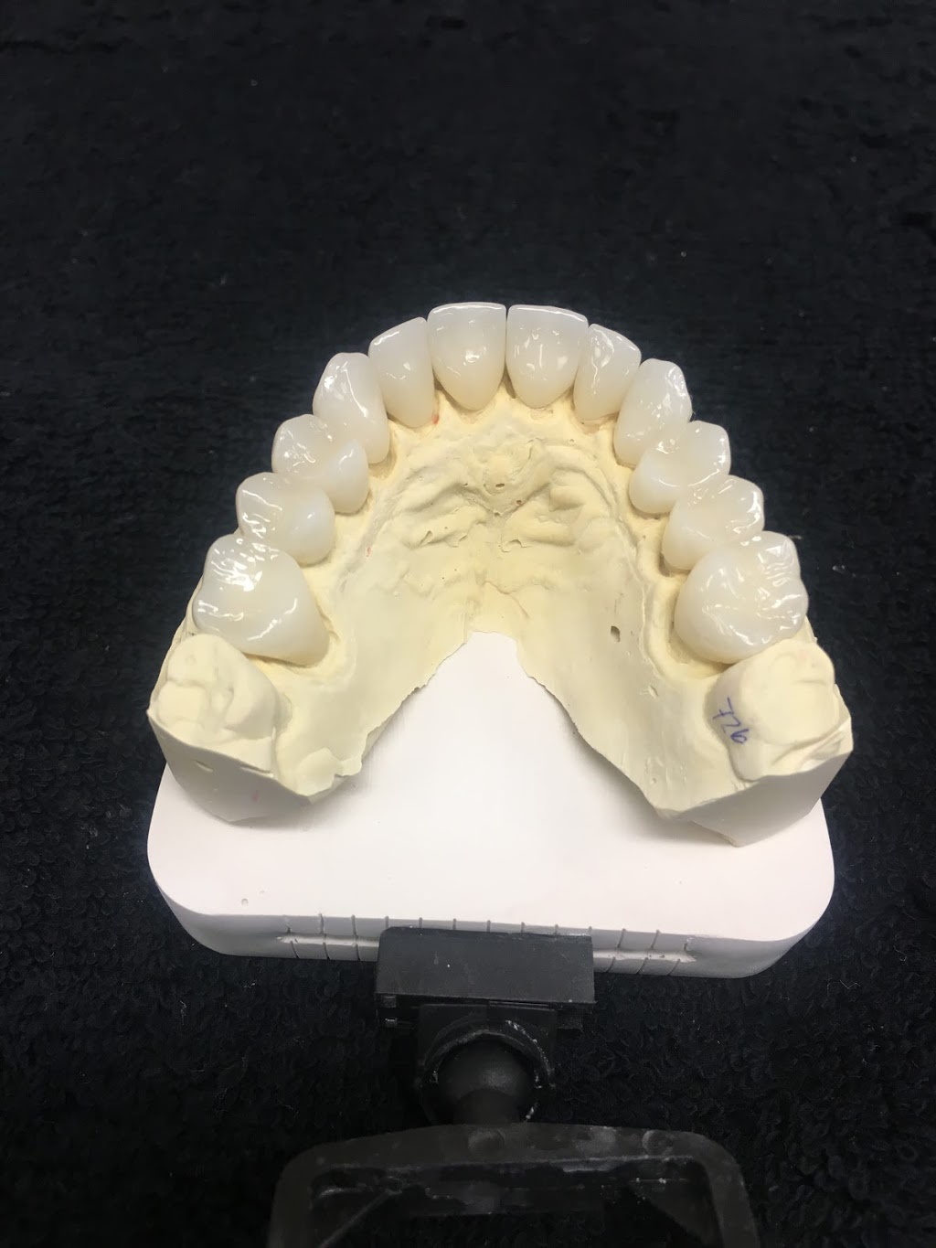 Proceram Dental Arts | 203-34654 Delair Rd, Abbotsford, BC V2S 2C9, Canada | Phone: (604) 853-7793