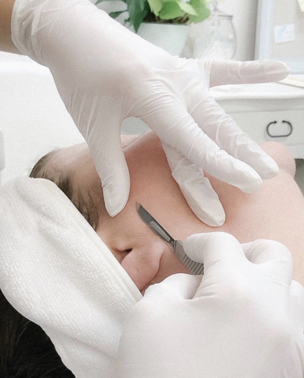 Purely Dermico, Laser Aesthetics & Skin Care | 462 Cheapside St, London, ON N5Y 3X2, Canada | Phone: (519) 702-8853