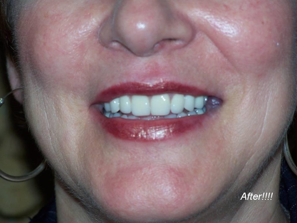Central Park Denture Clinic | 1711 Cook St, Victoria, BC V8T 3P2, Canada | Phone: (250) 388-4100