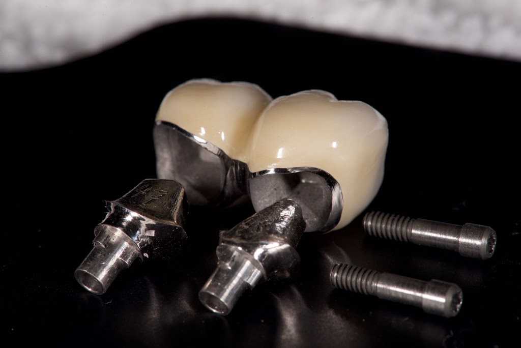 Pacific Skydent Dental Lab Ltd | 702-625 5th Ave, New Westminster, BC V3M 1X4, Canada | Phone: (604) 549-9922