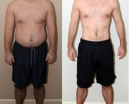 Laser Minceur Lazer Thin | 48 Rue Maillard, Gatineau, QC J8V 1Y3, Canada | Phone: (819) 500-3482
