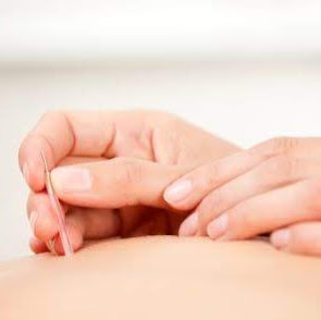 Elmira Olson Acupuncture (Westbrook) | 23 Fairway Dr NW, Edmonton, AB T6J 2S6, Canada | Phone: (780) 244-1095