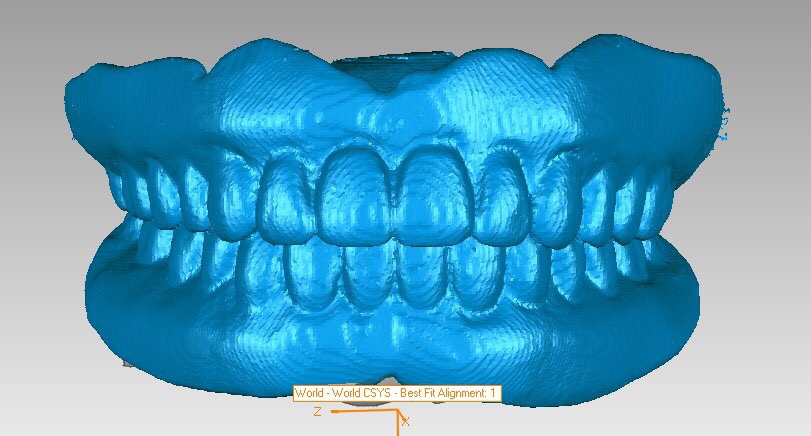 Bellwether Dental Implants & Oral Surgery | 12 Bellwether Way Ste 114, Bellingham, WA 98225, USA | Phone: (360) 366-8026