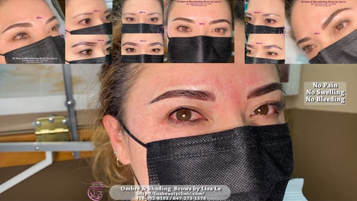 Lisa Beauty Clinic | 3220 Weston Rd, North York, ON M9M 2T7, Canada | Phone: (647) 273-1578
