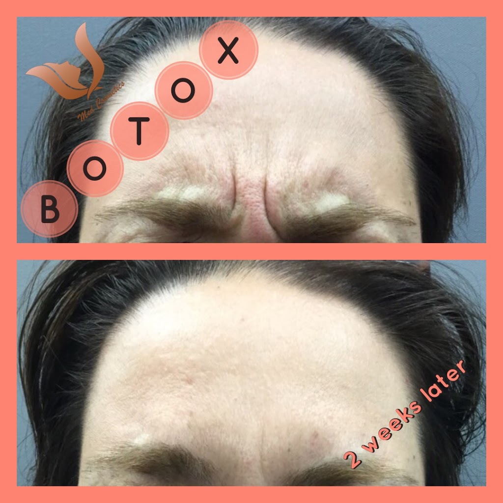 Med Cosmetics Clinic | 7700 Bathurst St #200, Thornhill, ON L4J 7Y3, Canada | Phone: (905) 597-5111