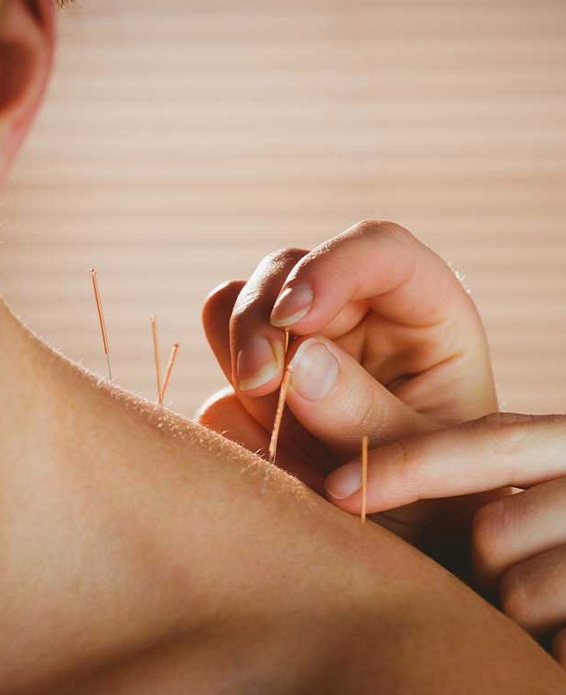 Acupuncture in Royal Vista | 164 Panamount Way NW, Calgary, AB T3K 0P7, Canada | Phone: (403) 993-3202