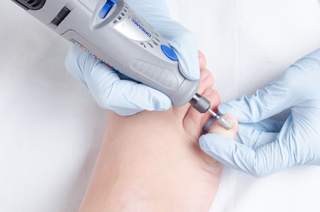 Trinity Foot Care | 3537 Summit Dr, Abbotsford, BC V2T 6S4, Canada | Phone: (604) 996-1823
