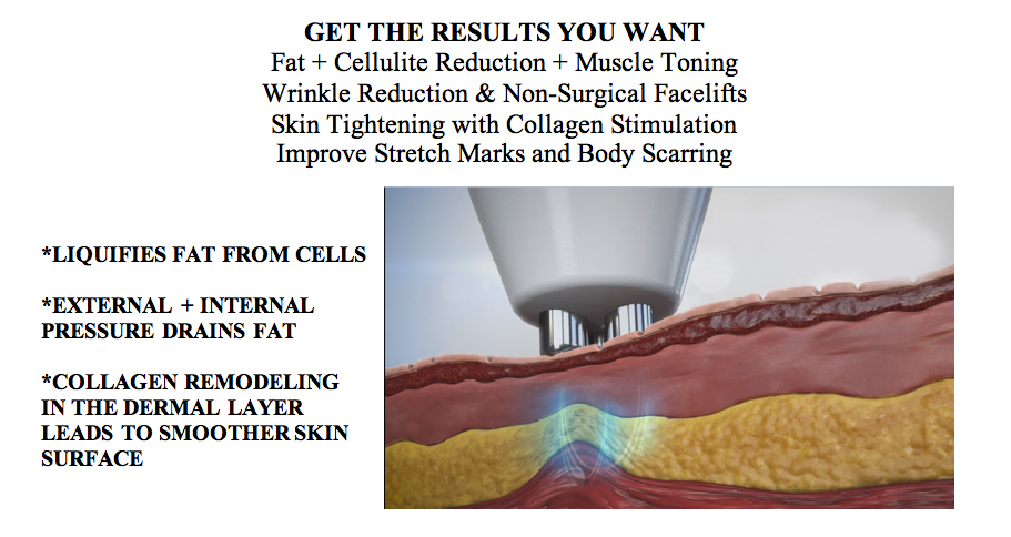Fonthill Laser Hair Removal | 6 Mussari Ct, Fonthill, ON L0S 1E4, Canada | Phone: (905) 931-7334