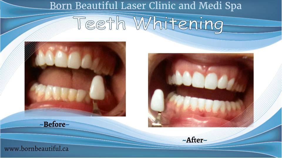 Born Beautiful Laser Clinic & Medi Spa | 21 Crowfoot Rise NW, Calgary, AB T3G 4P5, Canada | Phone: (403) 719-9900