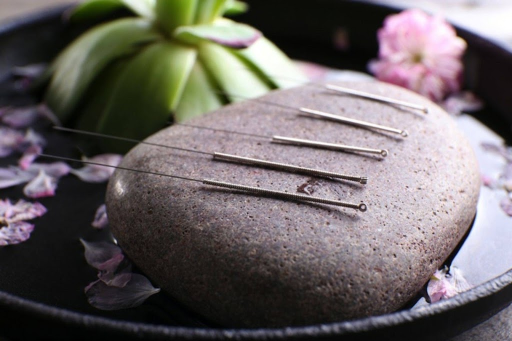Acupuncture Isabelle Dufresne - Sherbrooke | 1871 Rue Galt O, Sherbrooke, QC J1K 1J5, Canada | Phone: (819) 943-9897