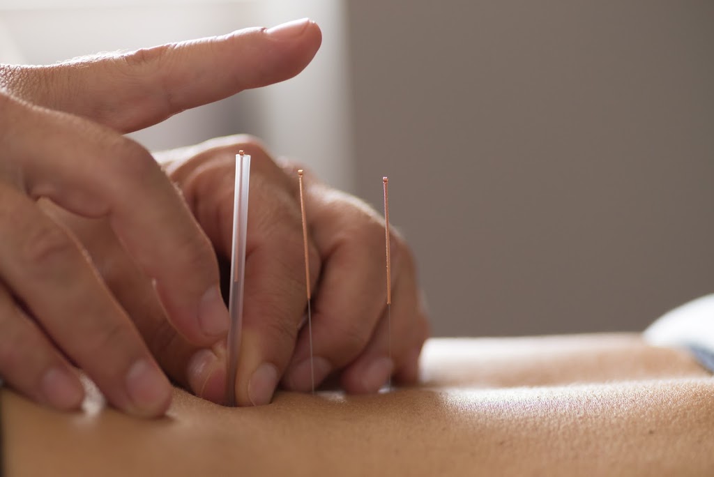 Back in Balance Muskoka Chiropractic & Acupuncture | 395 Centre St N Suite 102-7, Huntsville, ON P1H 2P9, Canada | Phone: (705) 571-2250