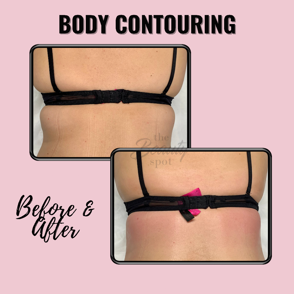 The Beauty Spot Corp. | 397 Kleinburg Smt Wy #1, Kleinburg, ON L4H 4T1, Canada | Phone: (647) 778-7356