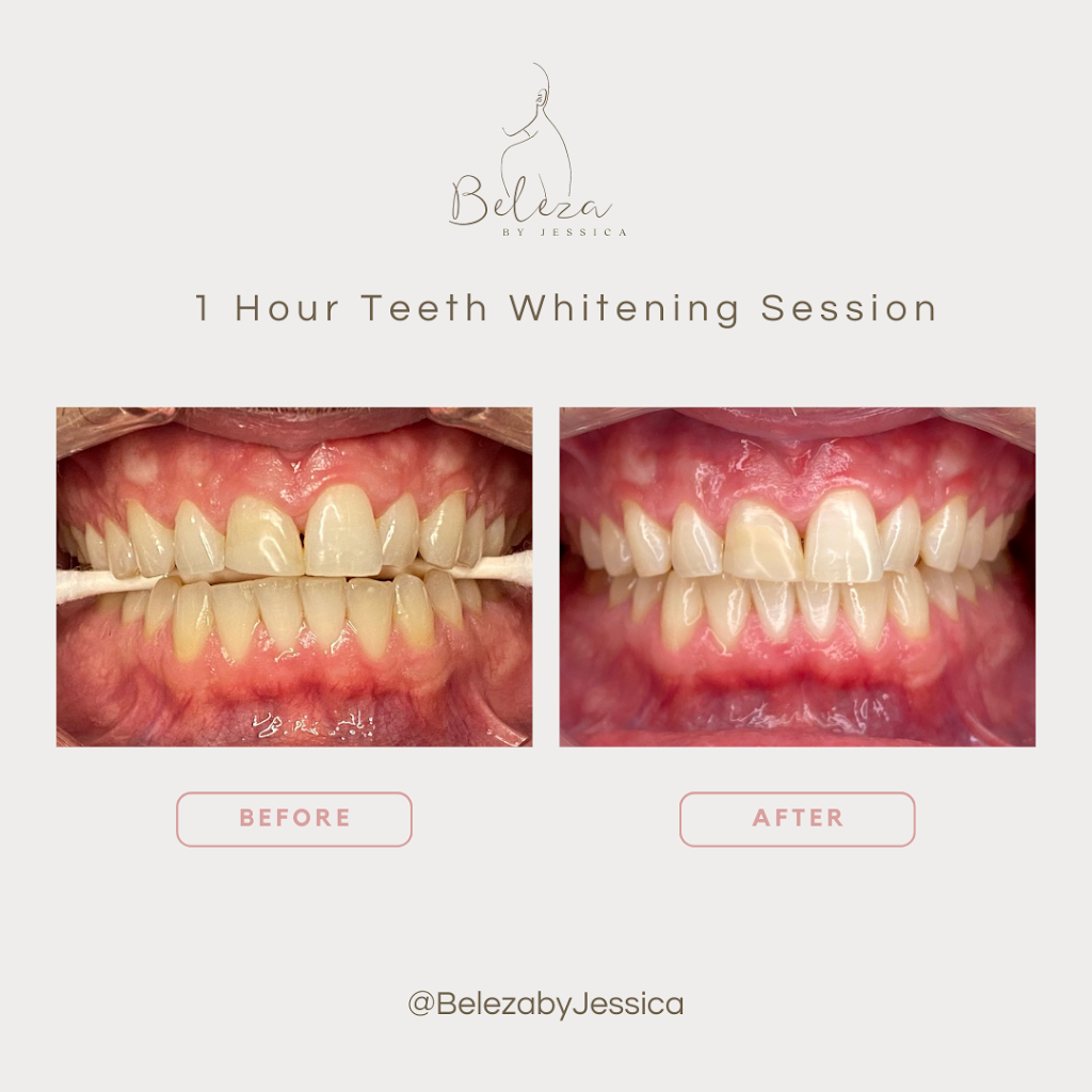 Beleza By Jessica | 406 Cundles Rd W, Barrie, ON L4N 7C6, Canada | Phone: (416) 558-1423