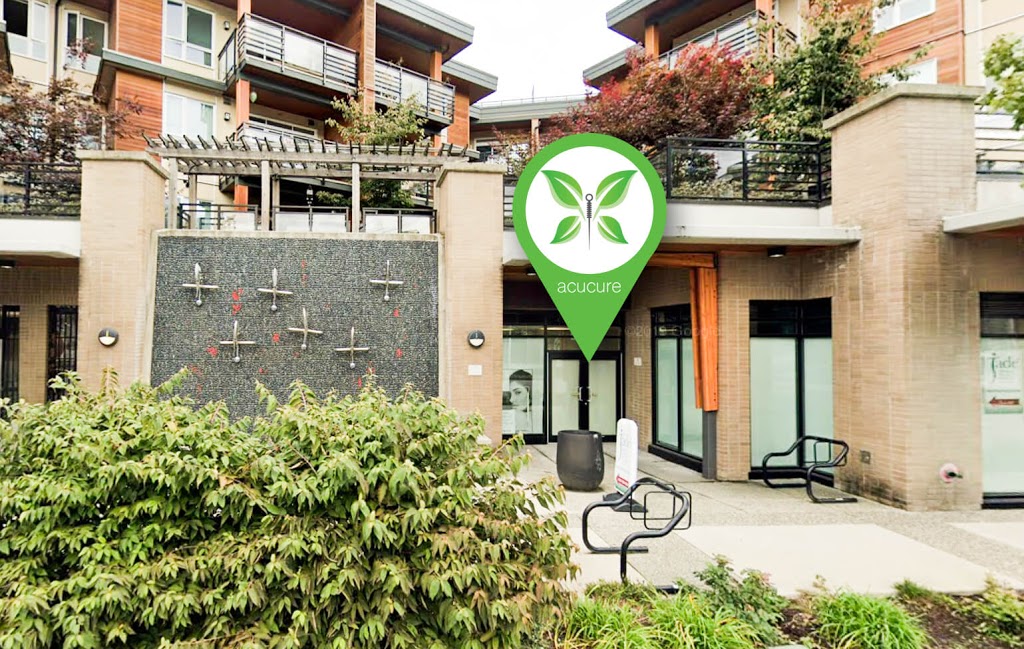 Acucure Acupuncture North Vancouver | 738 Marine Dr, North Vancouver, BC V7M 1H3, Canada | Phone: (778) 200-7543