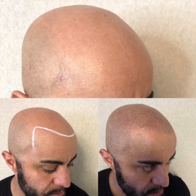 Ink2scalp | 6 Teardrop Crescent, Whitby, ON L1M 2N9, Canada | Phone: (905) 259-1251