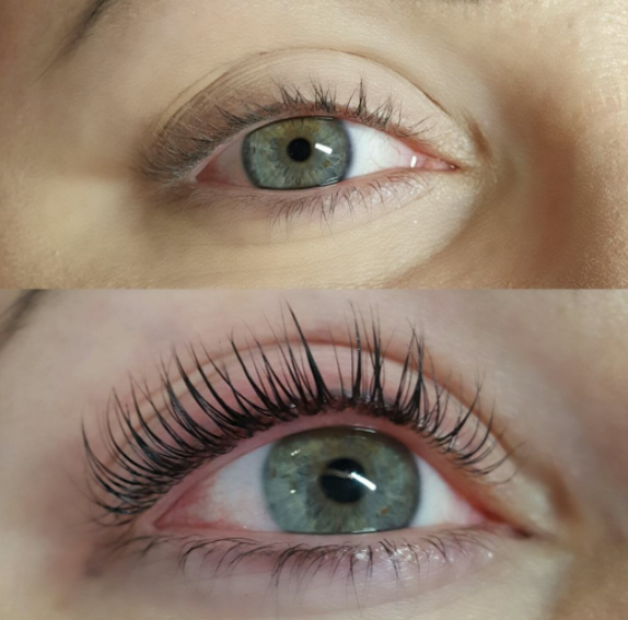 Fresh Facials and Lash | 2610 46 St SE, Calgary, AB T2B 1K9, Canada | Phone: (587) 586-9177