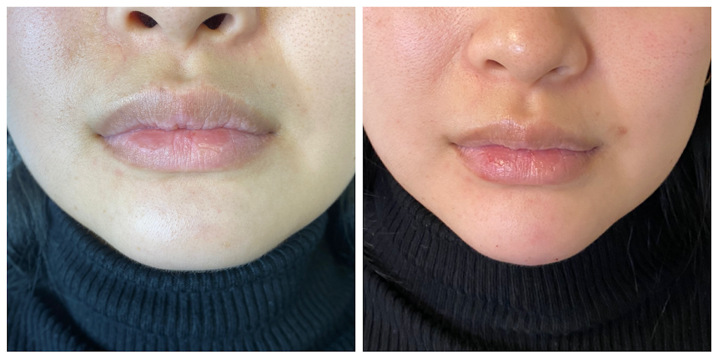 Clinique my face | 5551 Bd Laurier Suite 202, Terrebonne, QC J7M 1T7, Canada | Phone: (514) 980-6228