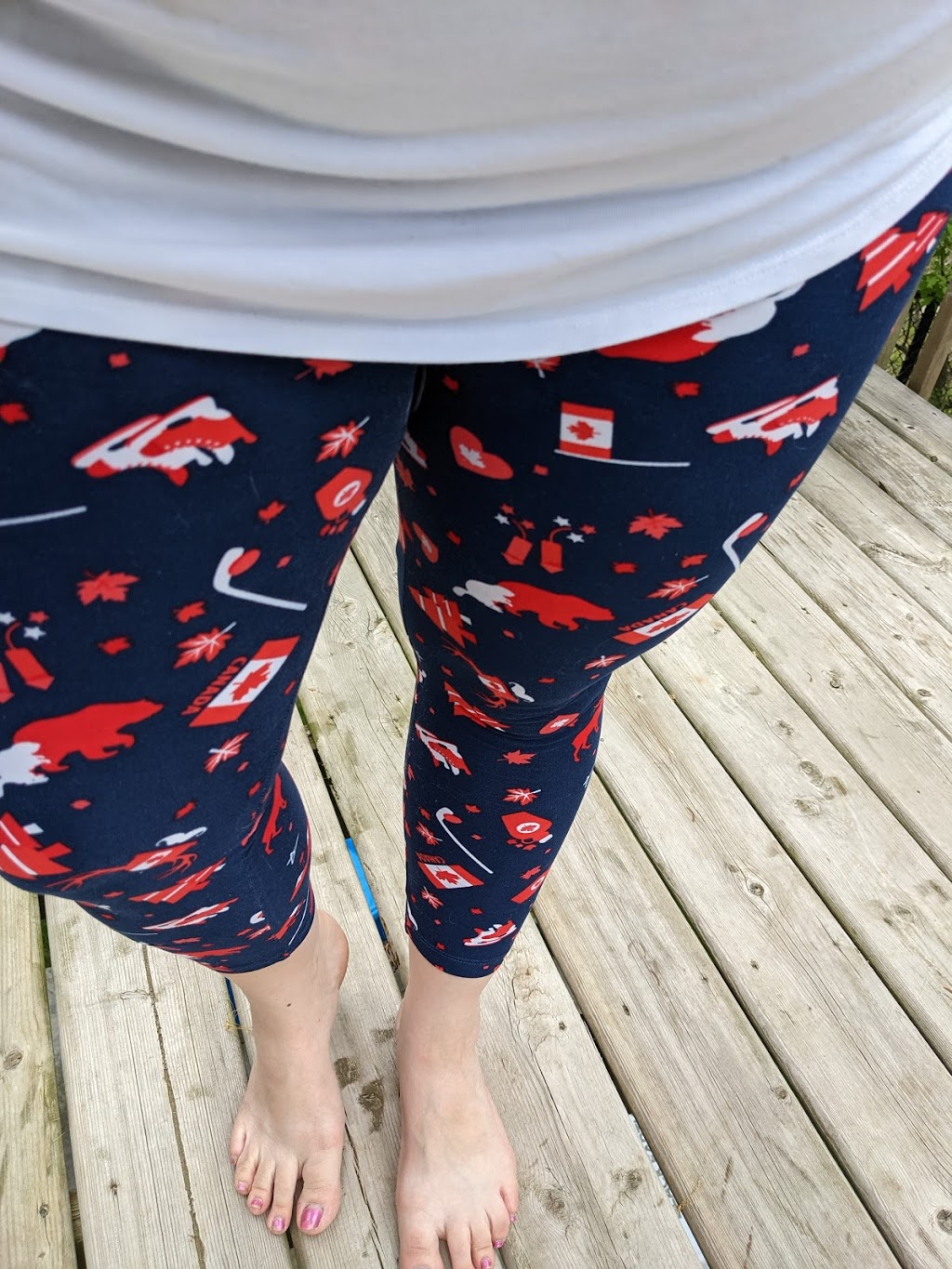 Sweetlegs Cambridge With SherryD | 15 Elma Pl, Cambridge, ON N3C 4E6, Canada | Phone: (519) 841-3053