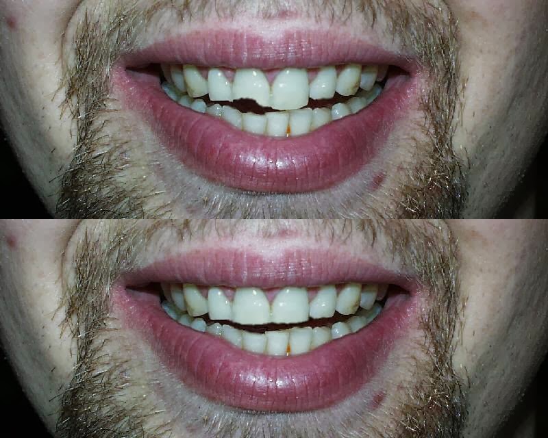Parkside Dental | 205 Norfolk St N, Simcoe, ON N3Y 3N9, Canada | Phone: (519) 428-2506