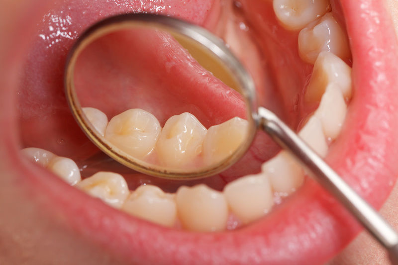 Dr. Ricky Leung | Dental Office | 2900 Steeles Ave E #201, Thornhill, ON L3T 4X1, Canada | Phone: (905) 881-3434