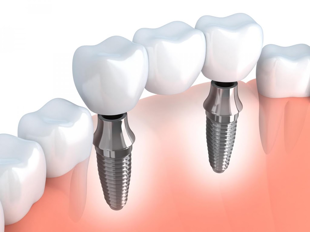 Trio Dentistry | 3163 Winston Churchill Blvd, Mississauga, ON L5L 2W1, Canada | Phone: (905) 812-1818