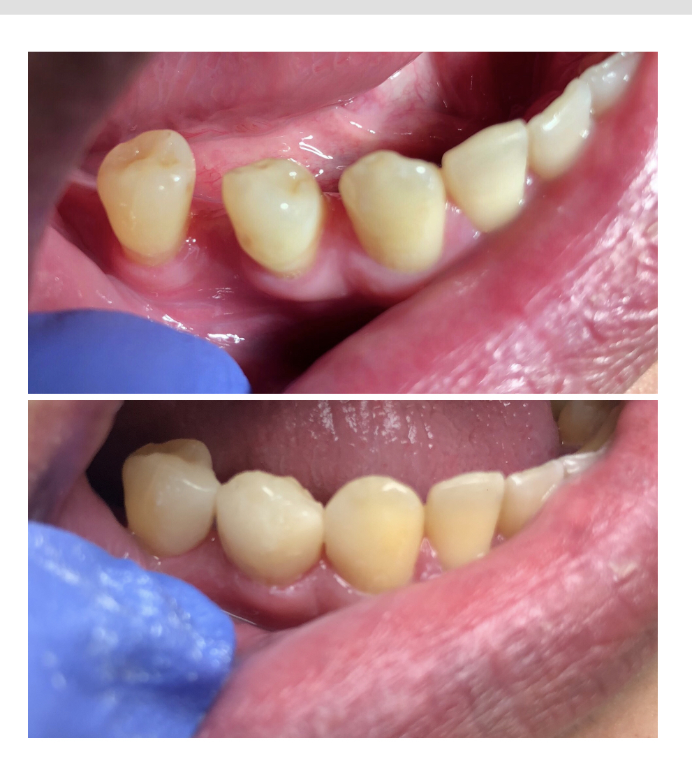 Swansea Dentistry | 2489 Bloor St W #103, Toronto, ON M6S 1R6, Canada | Phone: (416) 766-8005