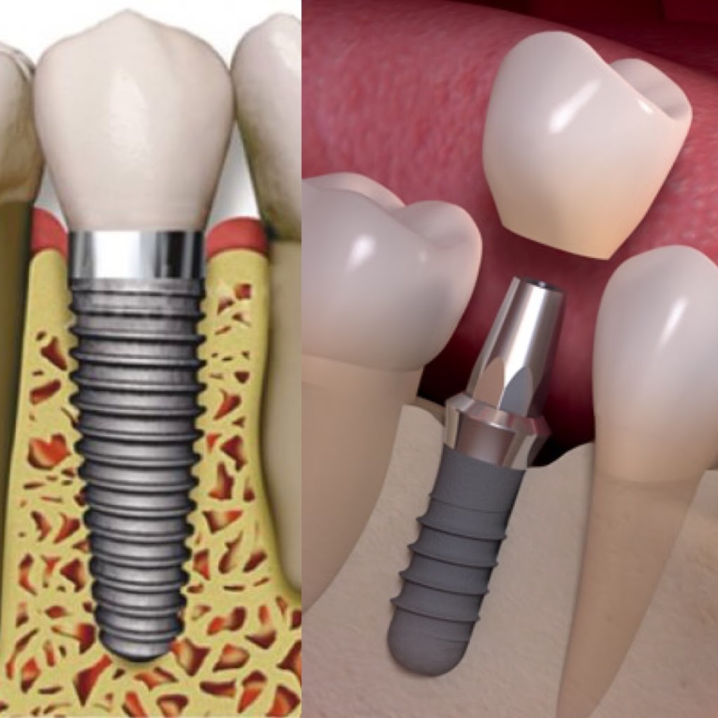 Burnaby Square Dental | 7885 6th St #210, Burnaby, BC V3N 3N4, Canada | Phone: (604) 526-2725