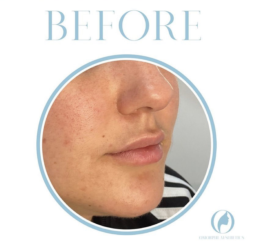 Omorphi Aesthetics | 71 Albert St Suite 6, Oshawa, ON L1H 4R1, Canada | Phone: (289) 355-9512