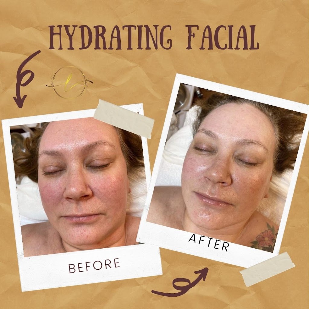 Luminate Derm Spa | 130 Bainbridge Crescent NW, Edmonton, AB T5T 6B4, Canada | Phone: (780) 266-8449