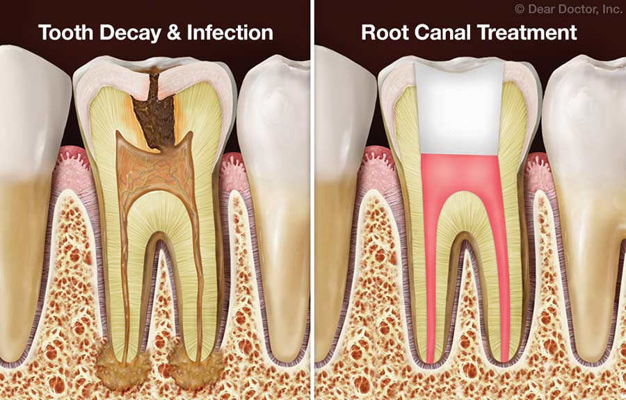 Didsbury Dental Centre | 2220 20 St, Didsbury, AB T0M 0W0, Canada | Phone: (403) 335-3855