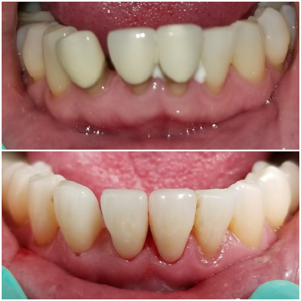Dr. Johnny Hung DDS | 720 Westmount Rd E Unit #10, Kitchener, ON N2E 2M6, Canada | Phone: (519) 745-2333