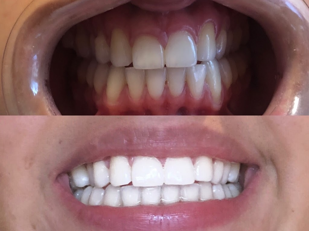 Caviar Smiles | 66 Walpole Ave #103, Toronto, ON M4L 3W5, Canada | Phone: (437) 220-9338