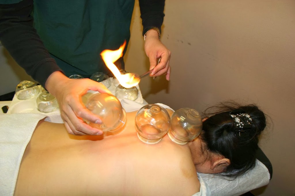 Dr.Yu Acupuncture Clinic | 2661 E Hastings St #1, Vancouver, BC V5K 1Z5, Canada | Phone: (604) 336-1696