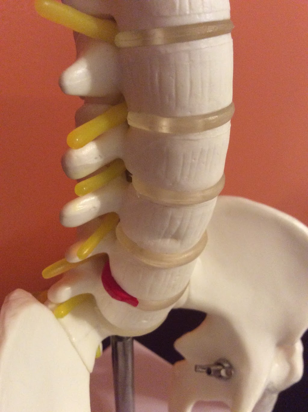 Clinique de physiothérapie Jean-Philippe Perreault | 815 175e Rue, Saint-Georges, QC G5Z 1B1, Canada | Phone: (418) 221-6050