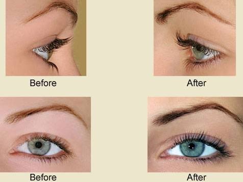 Esthetics By Gilla | 6 Calvert St, Nepean, ON K2G 1M3, Canada | Phone: (613) 567-6336