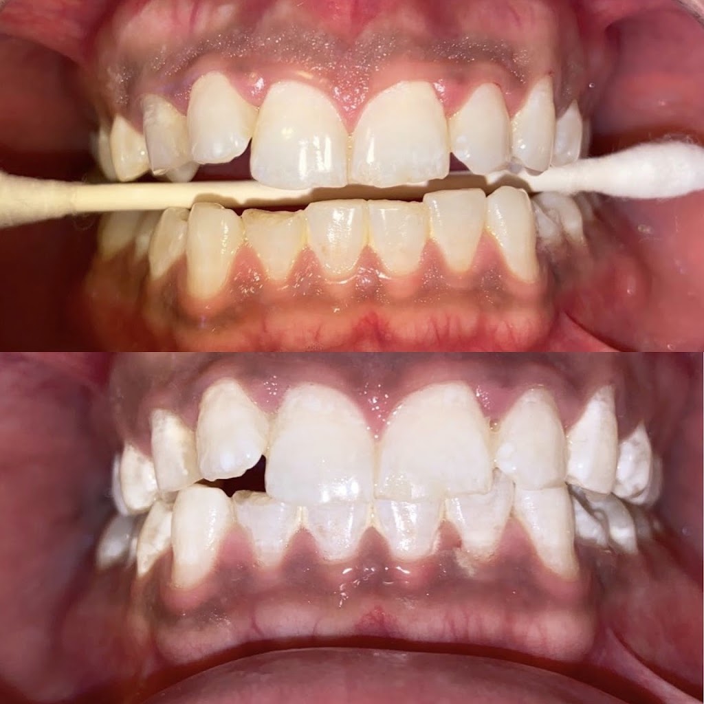 Blanche Smiles | 274 Markham Rd, Scarborough, ON M1J 3C5, Canada | Phone: (416) 885-1311