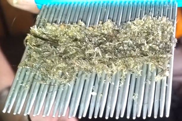 Lice Buster | 99 Maple St, Guelph, ON N1G 2G5, Canada | Phone: (647) 949-5423