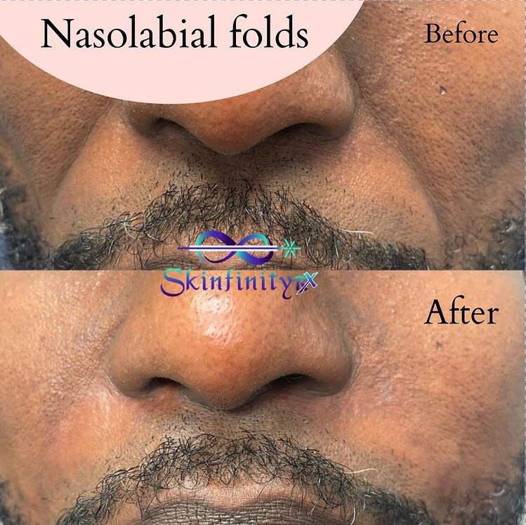 Skinfinity Aesthetics | Queens Medical Centre, 128 Queen St S #4A, Mississauga, ON L5M 1K8, Canada | Phone: (905) 592-4777