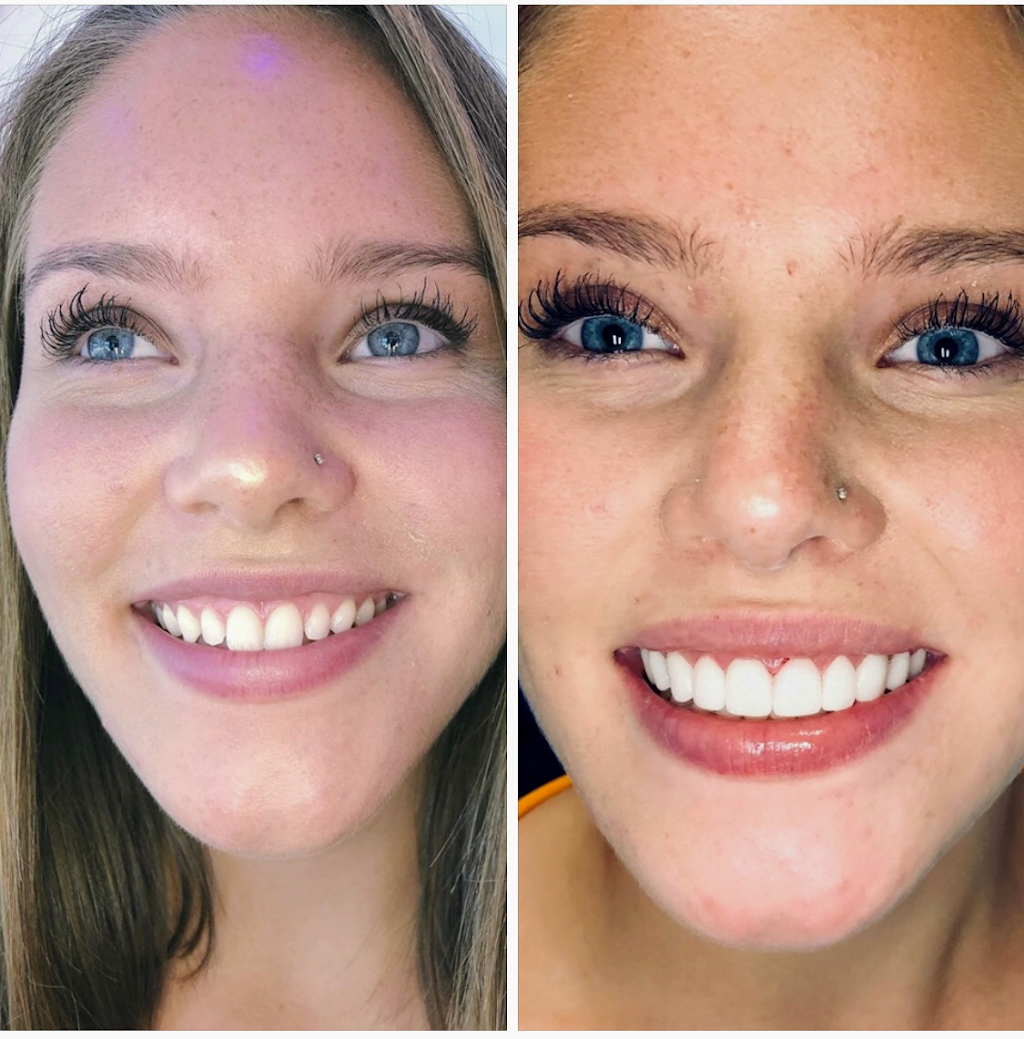 Artistic Dentists of Bellingham at Bellwether Dental | 12 Bellwether Way Ste 114, Bellingham, WA 98225, USA | Phone: (360) 366-8026