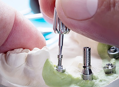 Trillium Smile Dentistry | 2000 Credit Valley Rd #112, Mississauga, ON L5M 4N4, Canada | Phone: (905) 828-9894