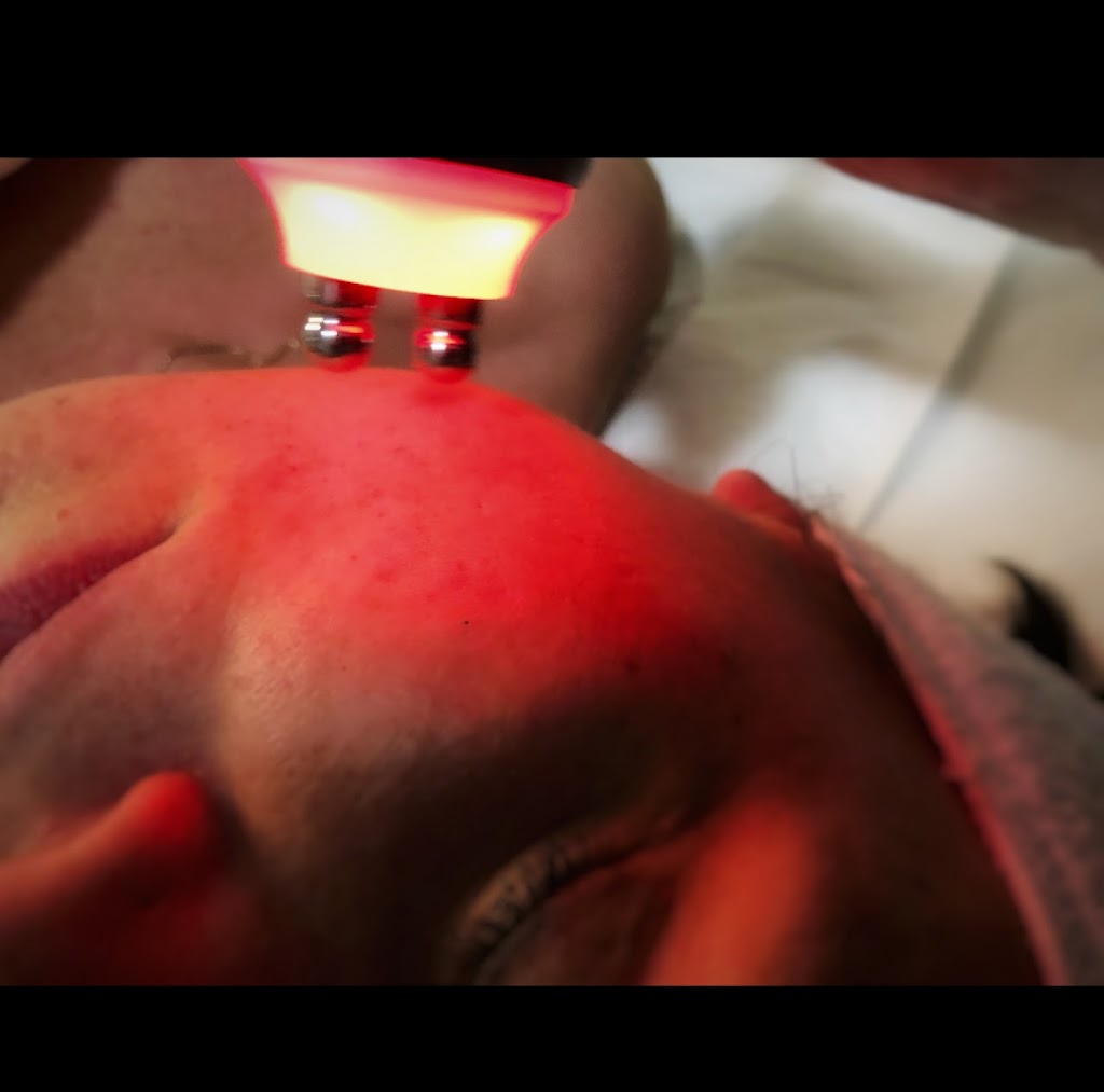 NuYou MedSpa + laser clinic | 671 Larry Uteck Blvd Suite 407, Bedford, NS B4A 4H4, Canada | Phone: (902) 422-7327