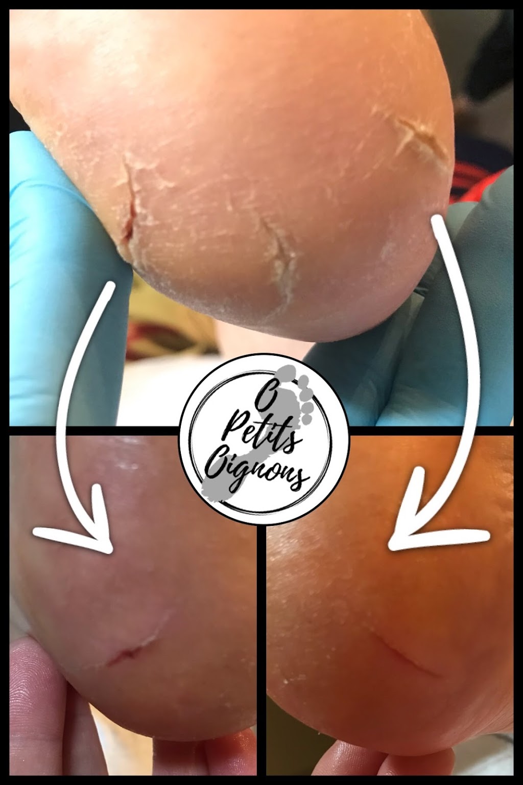 soins des pieds O petits oignons | 49 Rue du Hauban, Oka, QC J0N 1E0, Canada | Phone: (514) 627-8408