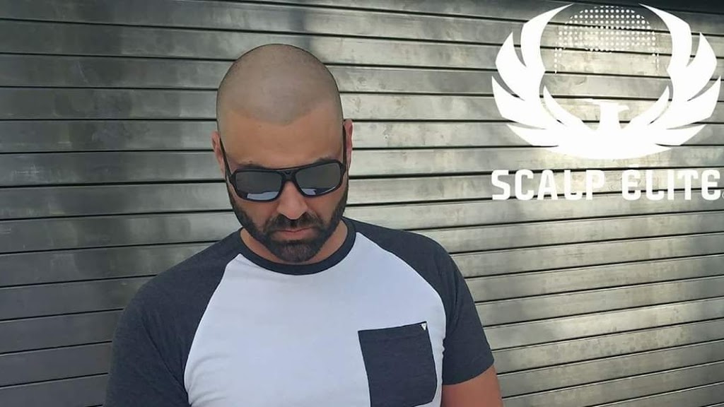 Micropigmentation Capillaire Scalp Élite Sherbrooke | 121 QC-216, Stoke, QC J0B 3G0, Canada | Phone: (819) 434-7477