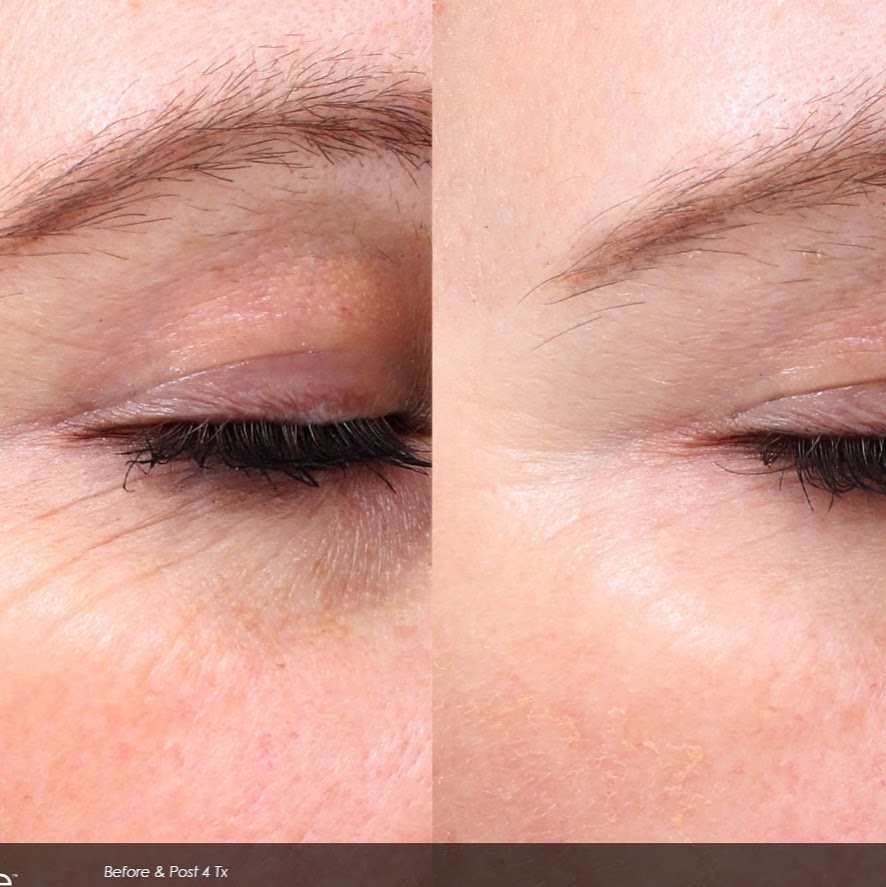 Liberty Laser Clinic | 132 Atlantic Ave, Toronto, ON M6K 1X9, Canada | Phone: (416) 737-1376