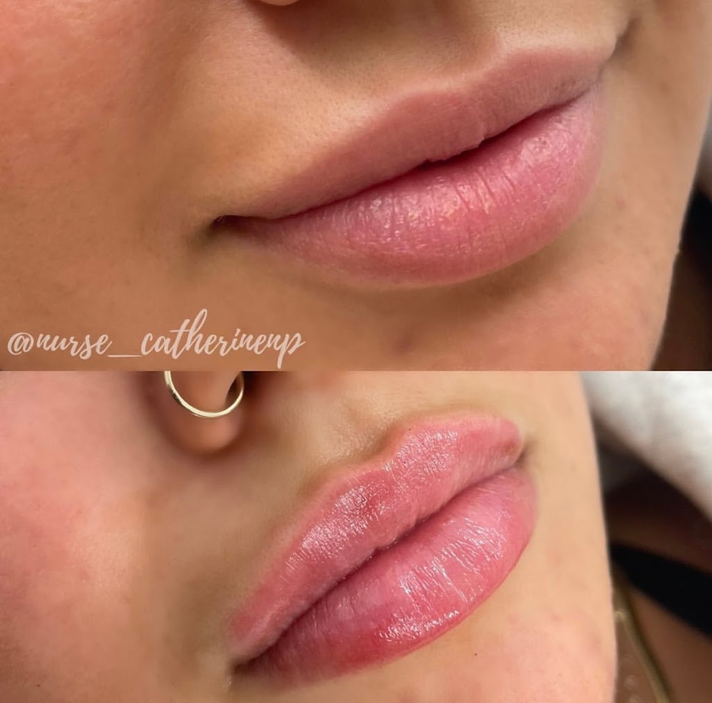 Monarchy Medispa Halifax | 480 Parkland Dr, Halifax, NS B3S 1P9, Canada | Phone: (902) 457-0525