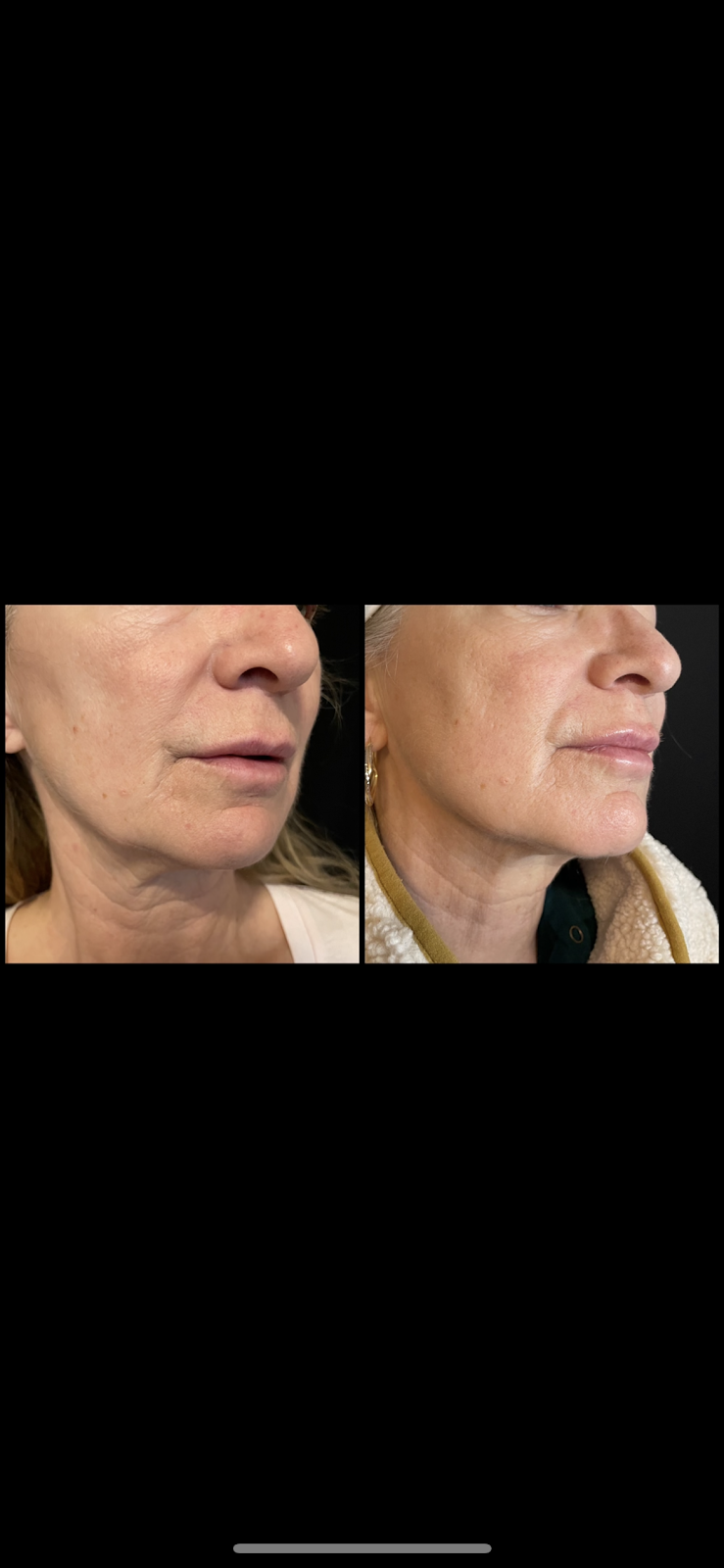 Alis Skin + Laser | 491 Wt Hill Blvd S #60, Lethbridge, AB T1J 1Y6, Canada | Phone: (403) 381-8295
