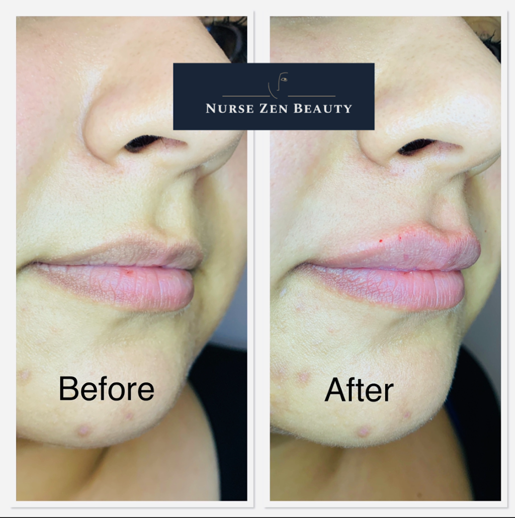 Zen Beauty | 8611 Weston Rd #19, Woodbridge, ON L4L 9P1, Canada | Phone: (416) 899-1068