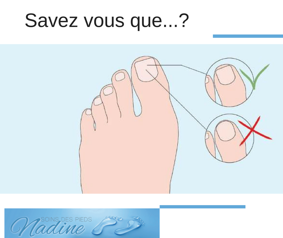 Soins des pieds Nadine | 1235 Rue Proulx, Les Cèdres, QC J7T 1E6, Canada | Phone: (438) 863-5393